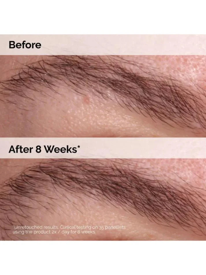 The Ordinary Multi-Peptide Lash and Brow Serum - 5ml