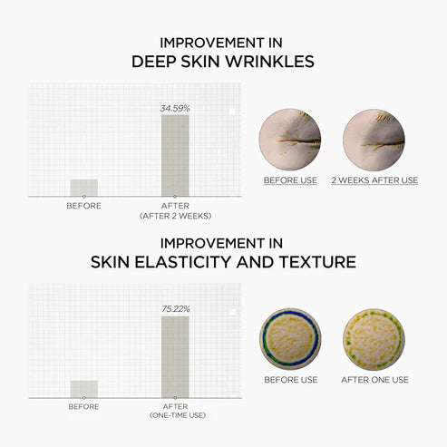 SKIN1004 أمبولة معززة من الريتينول بخلاصة نبات السنتيلا من مدغشقر بتركيز 0.2 ملغ، 30 مل