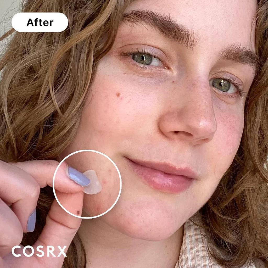 COSRX Acne Pimple Master Patch (A.D.F Hydrocolloid Dressing) - 24 patches/pack