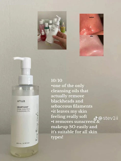 The Ana Hartle Full Skincare Set - Acne and Dark Spot Routine (5 Steps)
