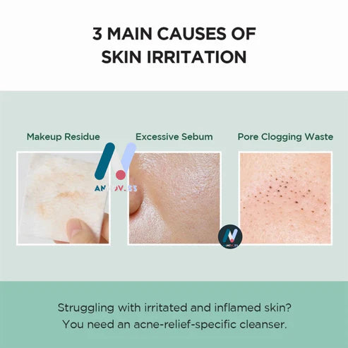 مجموعة SKIN1004 شاي سنتيلا مدغشقر - تريكا، للبشرة المعرضة لحب الشباب، حاجز البشرة، تهدئة البشرة وترطيبها