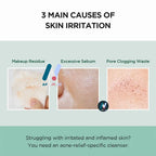 مجموعة SKIN1004 شاي سنتيلا مدغشقر - تريكا، للبشرة المعرضة لحب الشباب، حاجز البشرة، تهدئة البشرة وترطيبها